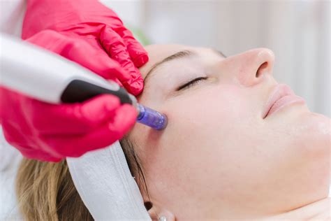 Skin Needling .